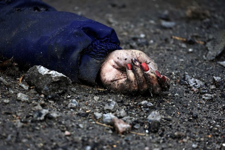 Hand einer ermordeten Frau in Butscha